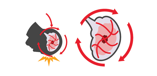 Impact-01-Rotational